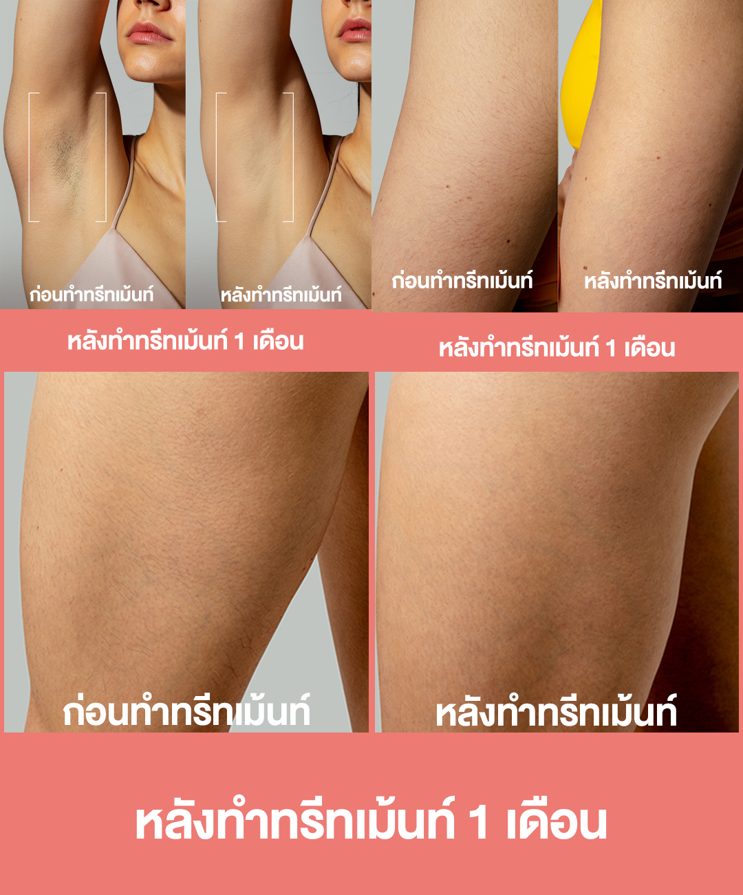 PEACH2-5
