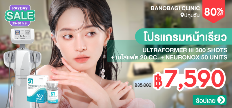 06-MB-BANOBAGI-338509
