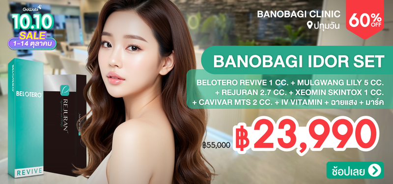 06-MB-BANOBAGI-333665