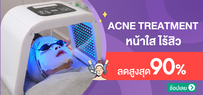 00-MB-Acne-treatment