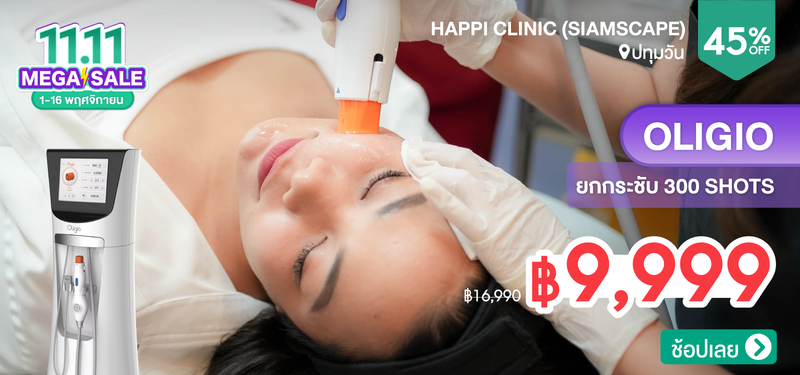 04-MB-Happi-303968