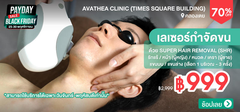 04-MB-Avathea-353660