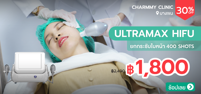 01-MB-Charmmy-373707