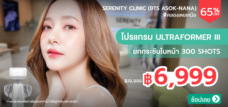 01-MB-Serenity-372216
