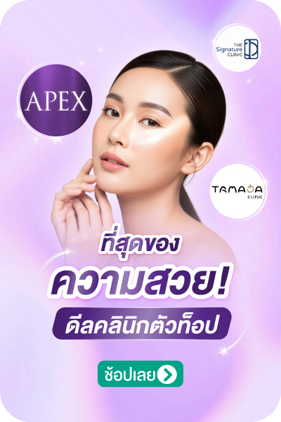 Widget-banner-Super-Brand1