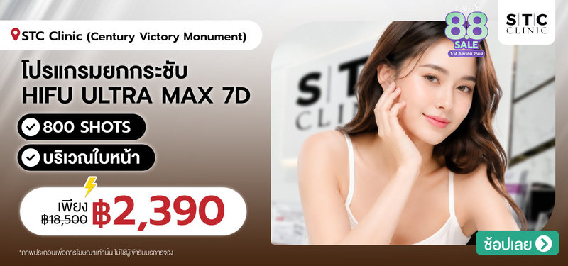 02-MB-STCClinic-369316