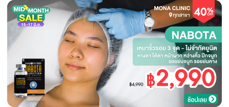 04-MB-Mona-228874