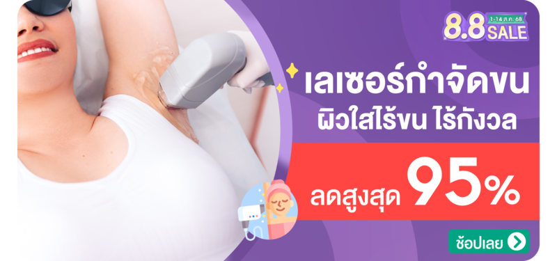 02-MB-%E0%B9%80%E0%B8%A5%E0%B9%80%E0%B8%8B%E0%B8%AD%E0%B8%A3%E0%B9%8C%E0%B8%81%E0%B8%B3%E0%B8%88%E0%B8%B1%E0%B8%94%E0%B8%82%E0%B8%99