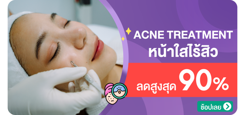 02-MB-Acne