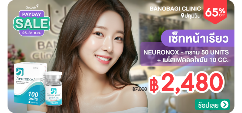 03-MB-BANOBAGI-279329