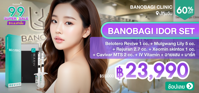 03-MB-BANOBAGI-333665