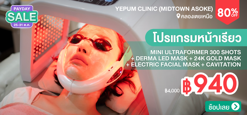 09-MB-Yepum-331890