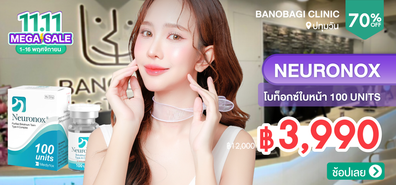 05-MB-BANOBAGI-327090