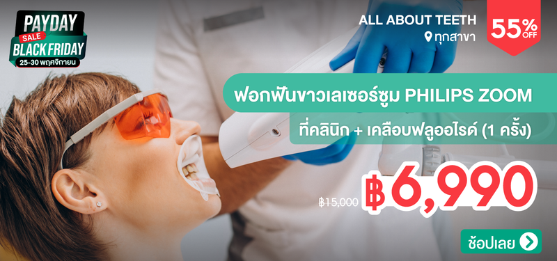 08-MB-Black-Friday-All-About-Teeth-159439