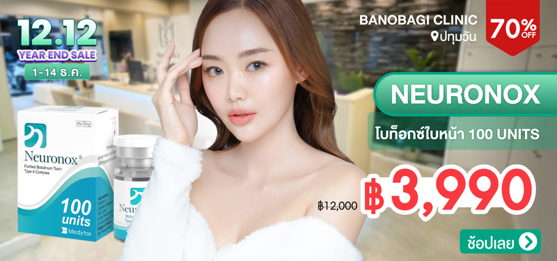 02-MB-BANOBAGI-327090