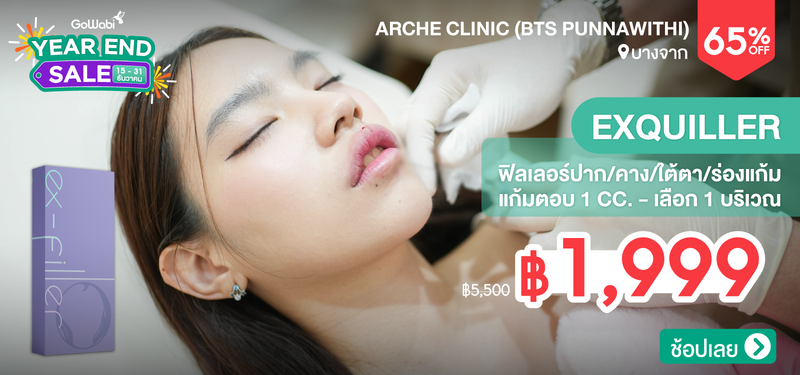 06-MB-Arche-359496