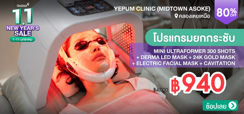 02-MB-Yepum-331890