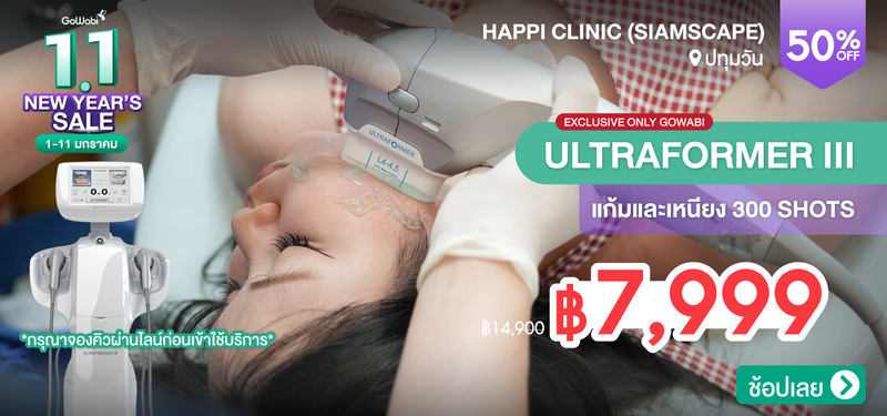 02-MB-Happi-278640