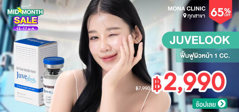 04-MB-Mona-258890