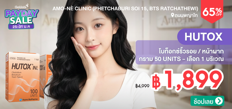 01-MB-Amone-364950