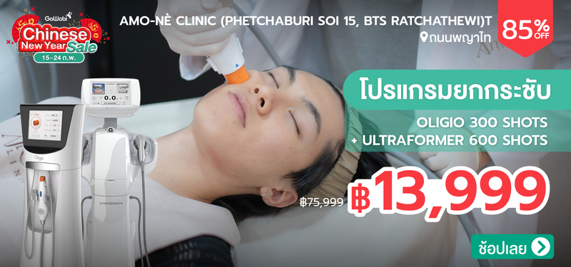 03-MB-Amone%CC%80-364944