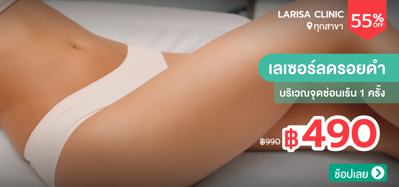 06-MB-Larisa-382132