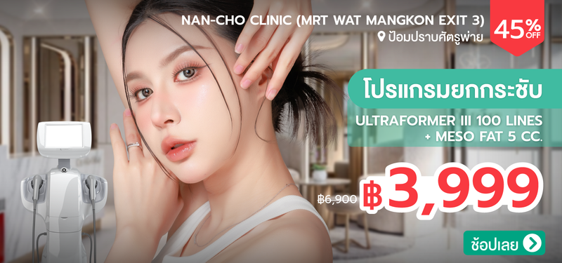 05-MB-NanCho-387941