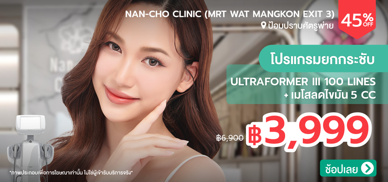 04-MB-NanCho-387941