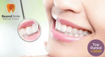 Beyond Smile Dental Clinic (Phra Khanong Branch)  Untitled-1Artboard_1_copy_2