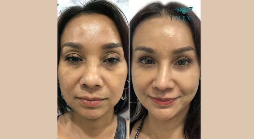 Theva Wellness Clinic Theva Wellness Clinic (ธีร์ว่าเวลเนส) %E0%B8%87%E0%B8%B2%E0%B8%99%E0%B8%AD%E0%B8%AD%E0%B8%81%E0%B9%81%E0%B8%9A%E0%B8%9A%E0%B8%97%E0%B8%B5%E0%B9%88%E0%B9%84%E0%B8%A1%E0%B9%88%E0%B8%A1%E0%B8%B5%E0%B8%8A%E0%B8%B7%E0%B9%88%E0%B8%AD_%2835%29