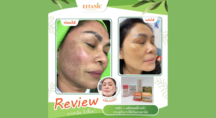 EITANIC  Beautycare (Phra Ngoen Branch)  4