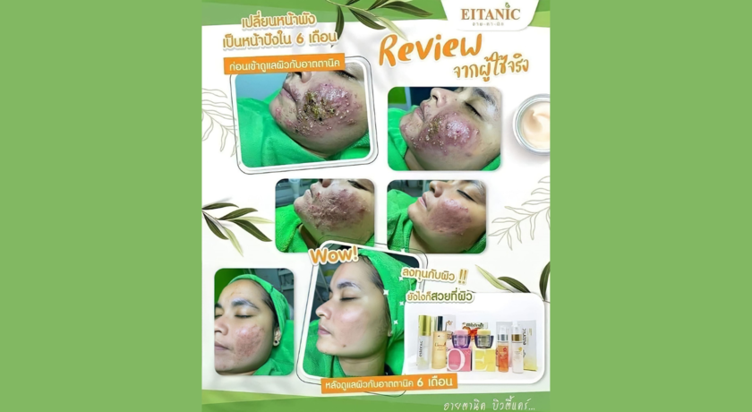 EITANIC  Beautycare (Phra Ngoen Branch)  8