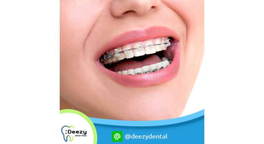 Deezy Dental Home (Khlong Luang Branch)  4