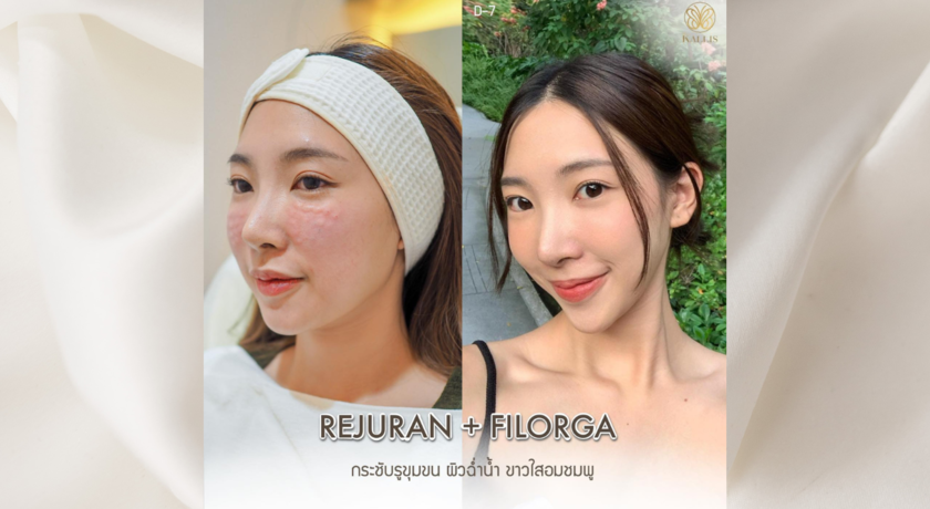 The Kallis Clinic (Rama 9 Branch)  27