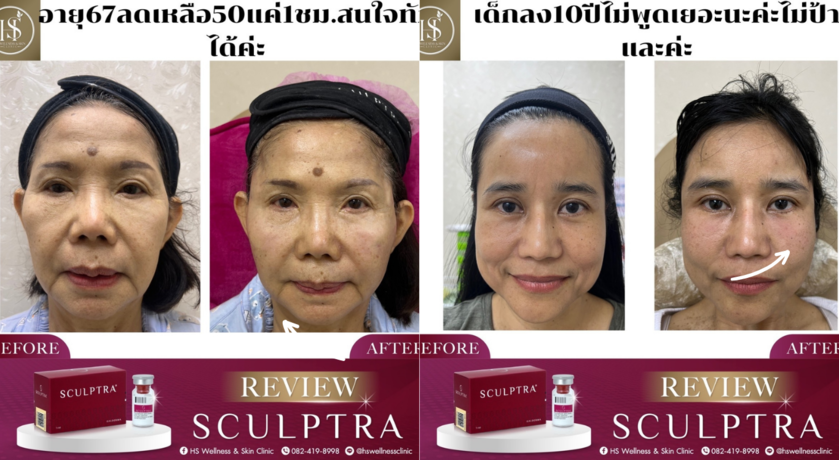 HS Wellness Clinic Hs wellness Clinic - เอชเอส เวลเนสคลินิก บริการวิเคราะห์ผิวเฉพาะบุคคล ย่านบางชัน 2