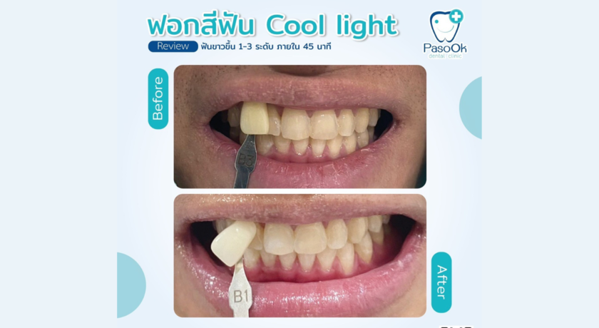Pasook Dental Clinic (The Fourth Sai4)  6