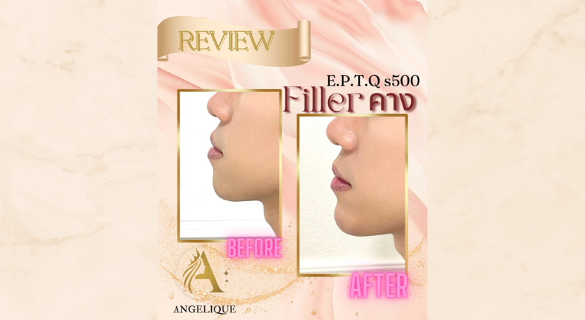Angelique Clinic  11