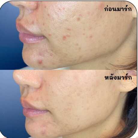 Dr.CherryBeauty Clinic  scaled_1000020215