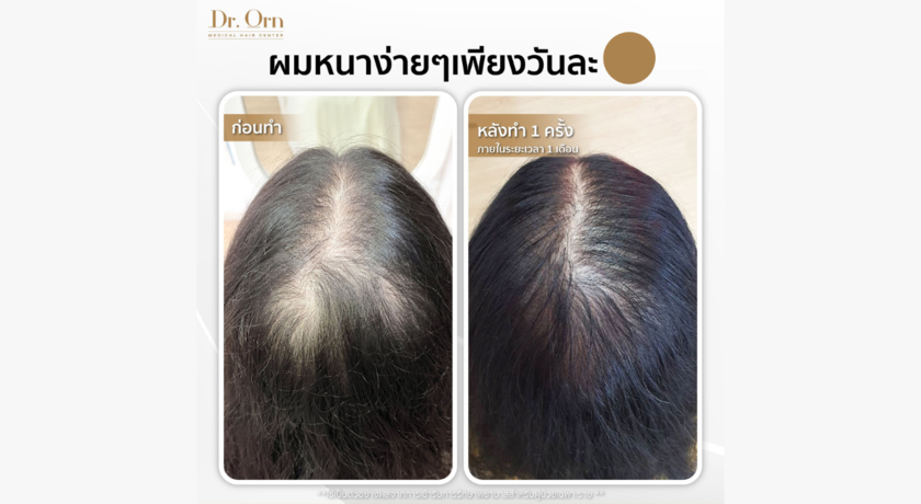 Dr.Orn Medical Hair Center (Phahonyothin 22)  4