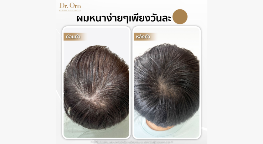 Dr.Orn Medical Hair Center (The Crystal Ekamai-Ramindra)  5