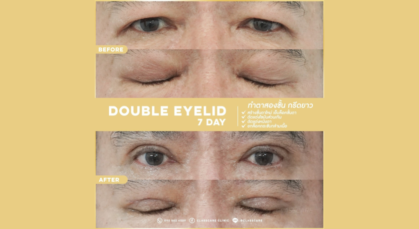 Classcare Surgery Clinic  3