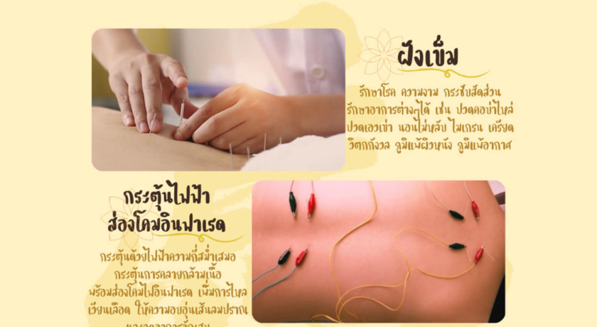 Majia Clinic (Chaengwattana) มาเจียคลินิก แจ้งวัฒนะ (ฝังเข็ม/ครอบแก้ว/ยาจีน)  8