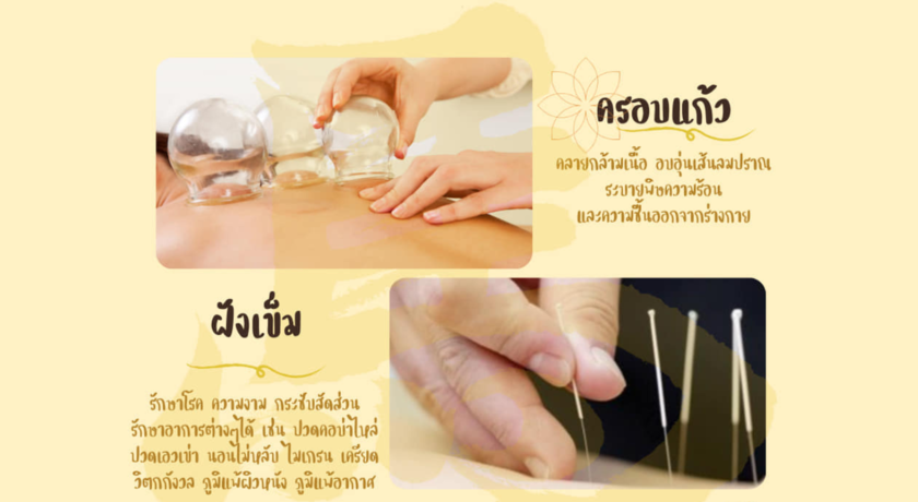 Majia Clinic (Chaengwattana) มาเจียคลินิก แจ้งวัฒนะ (ฝังเข็ม/ครอบแก้ว/ยาจีน)  10