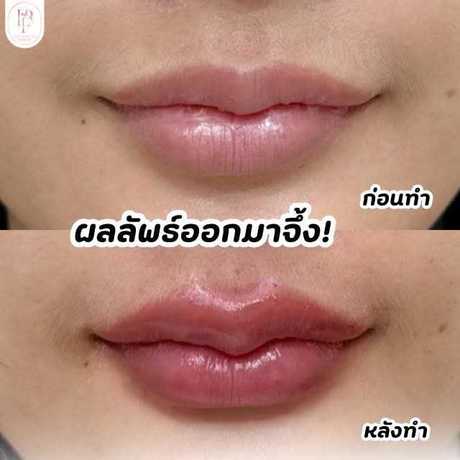 The Prefer Clinic (Workplace Petchkasem 81-2)  scaled_1000004892
