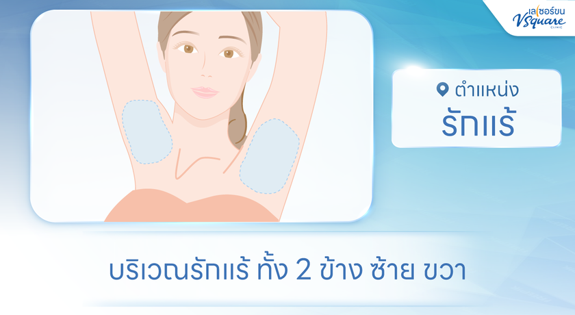 V Square Clinic (Paseo Kanchanaphisek)  %E0%B8%A3%E0%B8%B1%E0%B8%81%E0%B9%81%E0%B8%A3%E0%B9%89