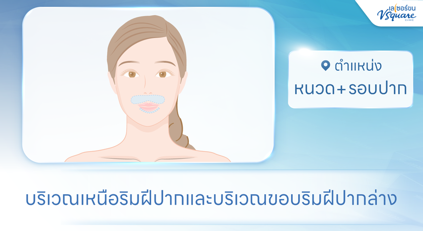 V Square Clinic (Paseo Kanchanaphisek)  %E0%B8%AB%E0%B8%99%E0%B8%A7%E0%B8%94_%E0%B8%A3%E0%B8%AD%E0%B8%9A%E0%B8%9B%E0%B8%B2%E0%B8%81