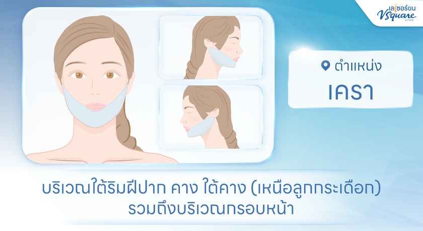 V Square Clinic (Paseo Kanchanaphisek)  %E0%B9%80%E0%B8%84%E0%B8%A3%E0%B8%B2