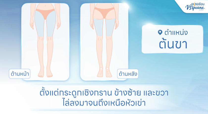 V Square Clinic (Paseo Kanchanaphisek)  %E0%B8%82%E0%B8%B2%E0%B8%9A%E0%B8%99