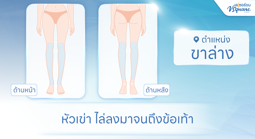 V Square Clinic (Paseo Kanchanaphisek)  %E0%B8%82%E0%B8%B2%E0%B8%A5%E0%B9%88%E0%B8%B2%E0%B8%87