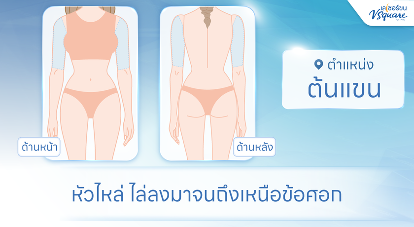 V Square Clinic (Paseo Kanchanaphisek)  %E0%B8%95%E0%B9%89%E0%B8%99%E0%B8%9A%E0%B8%99